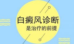 廣州中研白癜風(fēng)